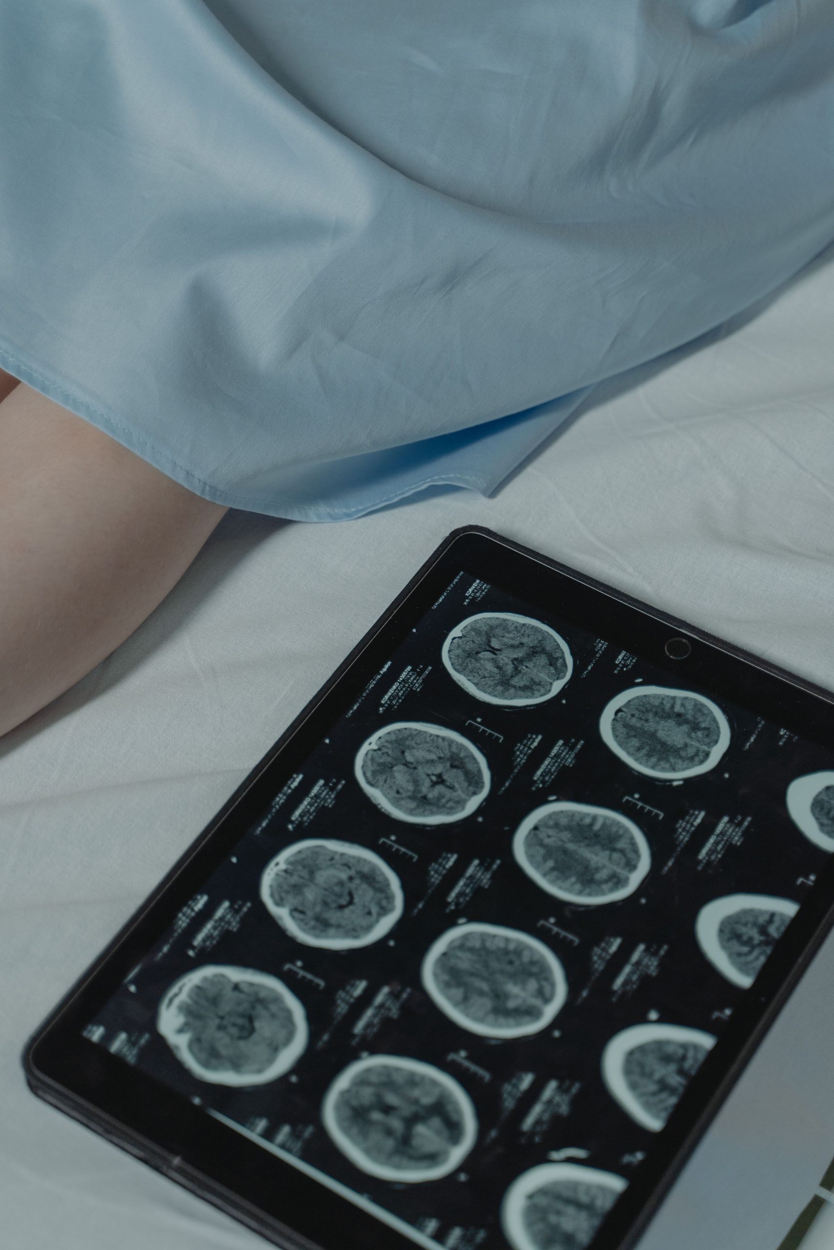 Brain-computer interface global industry and market growth