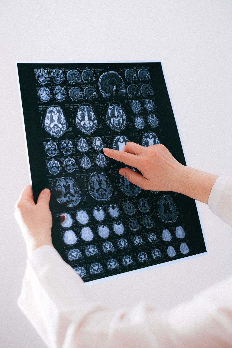 Brain-computer interface medical technology and clinical applications